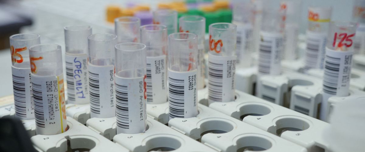 CDC awards Palantir consolidated disease surveillance contract worth $443M